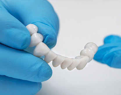 Are Crowns On Front Teeth Noticeable?