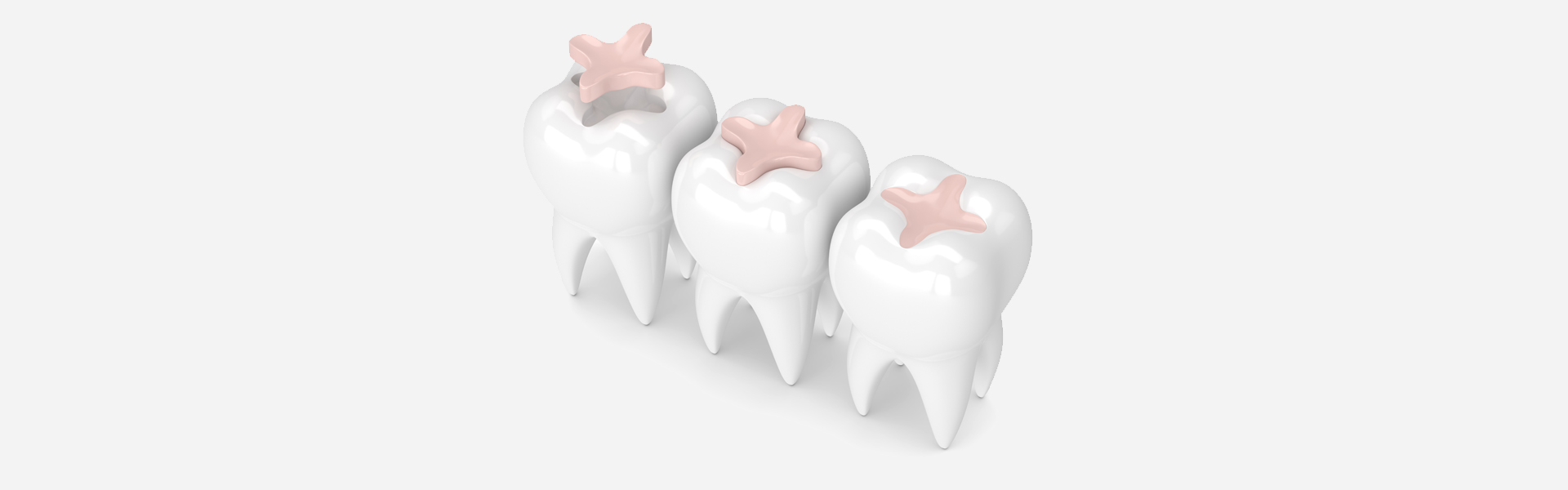 Are Fillings Considered Restorative?