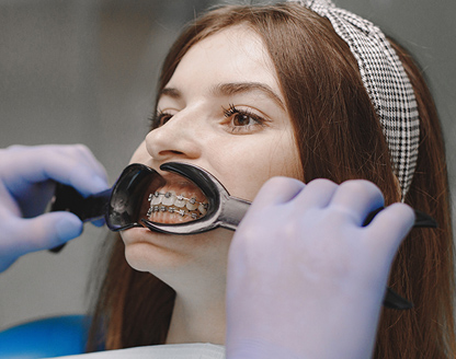 Orthodontic Aftercare: Maintaining Your New Smile for a Lifetime