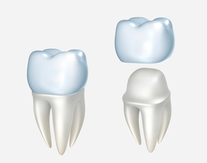 What Is the Procedure for Getting Dental Crowns, and How Long Does It Take?