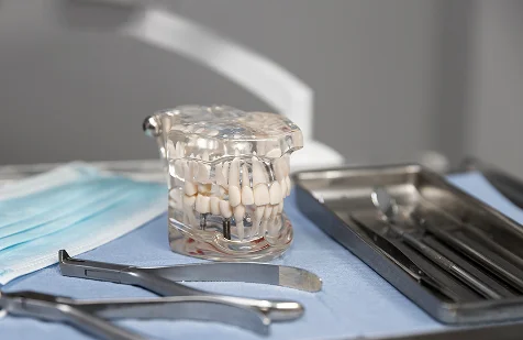 Dental Implant Model