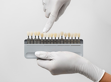 Dental Veneers in San Jose: Cost, Benefits, Procedure & What to Expect